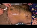 Hair Belly Relaxing Hair Belly Button Oil Massage Stress Relief ASMR Satisfying Body Care