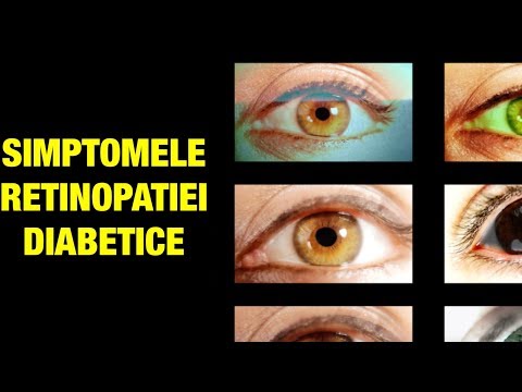 viziune umană după 40 de ani recuperarea vederii după o leziune pătrunzătoare