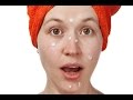 Fucidin Cream For Acne Scars