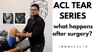 First Day of Physical Therapy Post ACL Surgery