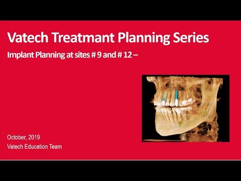 Ez3D-i : Software Quick & Easy Implant Planning