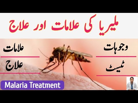 Malaria Treatment In Urdu Hindi | Malaria ka ilaj | Irfan Azeem |