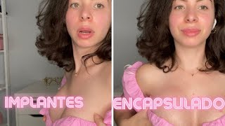 Tengo un Seno Encapsulados! Contractura Capsular les cuento mis Sintomas