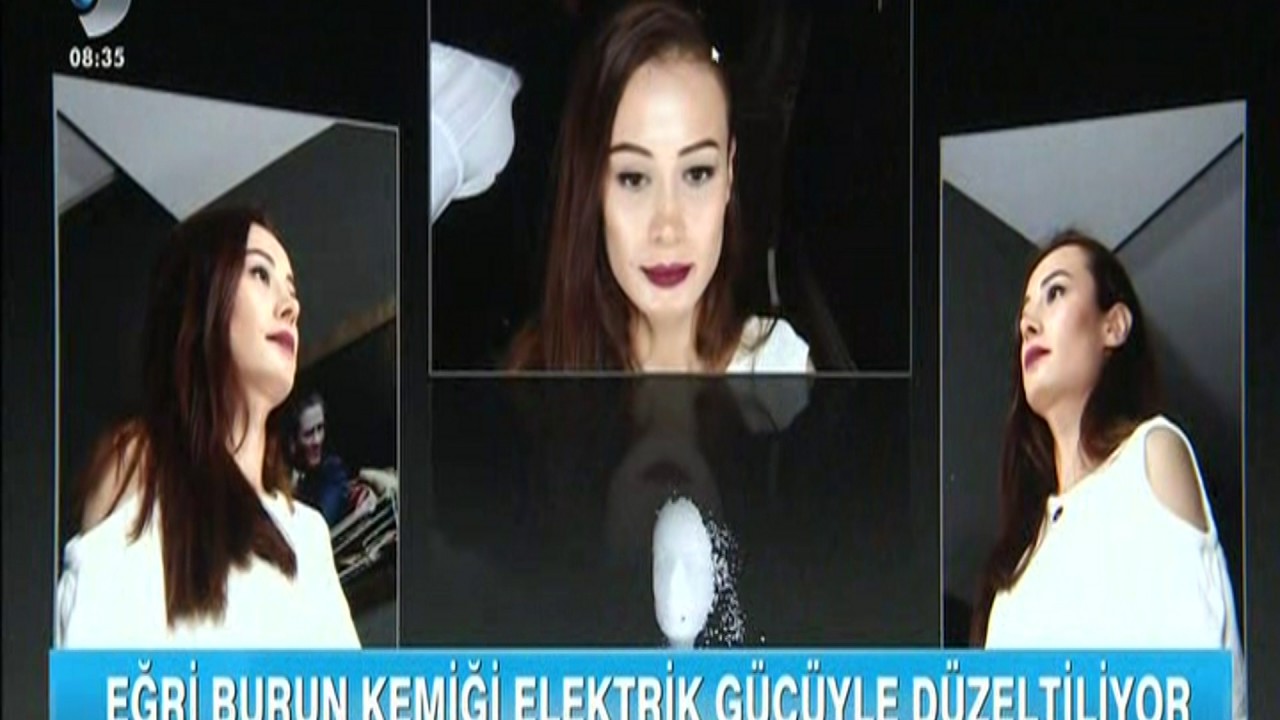 İTALYAN BURUN ESTETİĞİ