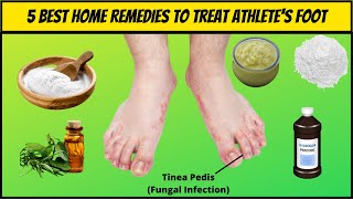 5 Best Natural Home Remedies For Athlete