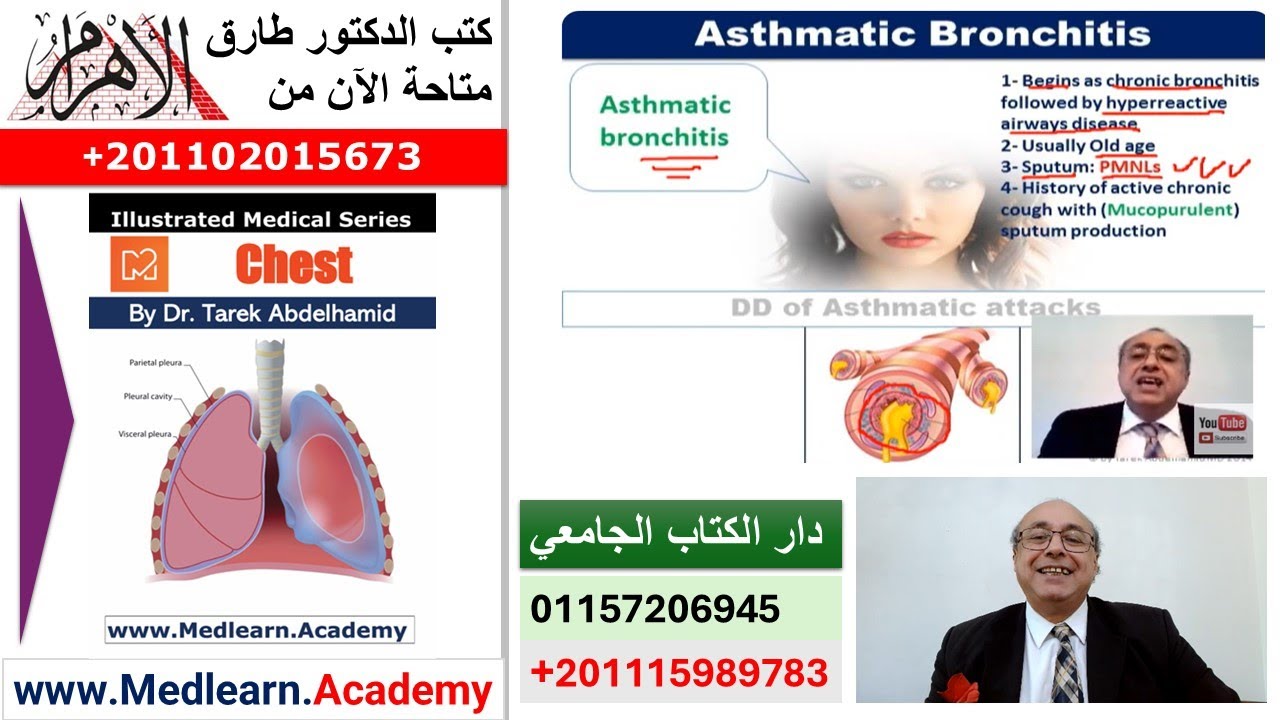 Chest (Differential Diagnosis of Asthma)  #cme #internal_medicine #medical #usmle #محاضرات_باطنة