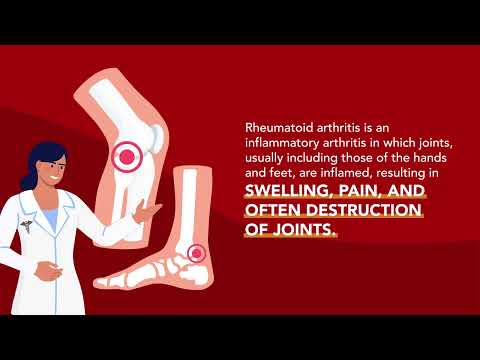 Joint Disorders: Rheumatoid Arthritis (RA) | Merck Manual Consumer Version