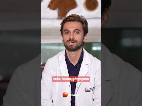 Göz Kuruluğu Belirtileri - Prof. Dr. Ahmet Akman