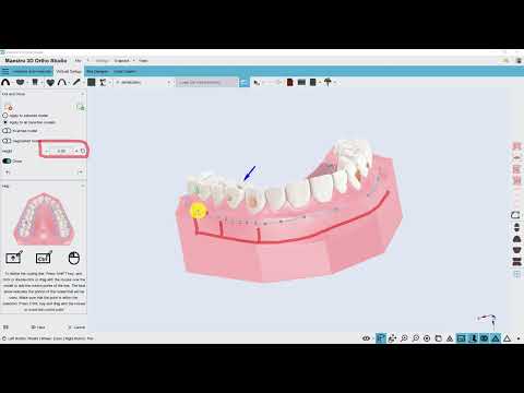 Découpe et Fermeture | Exportation des modèles de transition