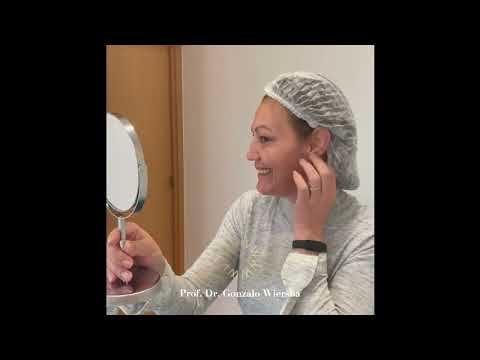 Testimonio / FULL FACE con Ácido Hialurónico