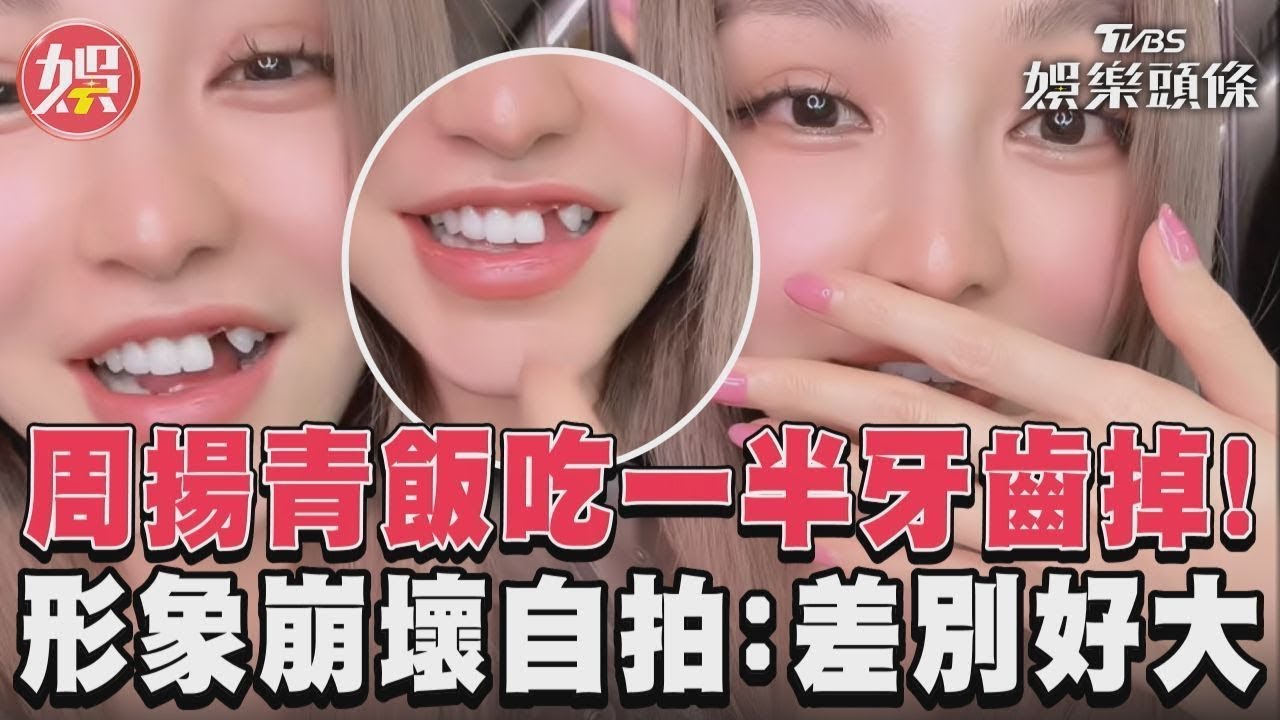 影音/周揚青飯吃一半牙齒掉! 形象崩壞自拍:差別好大