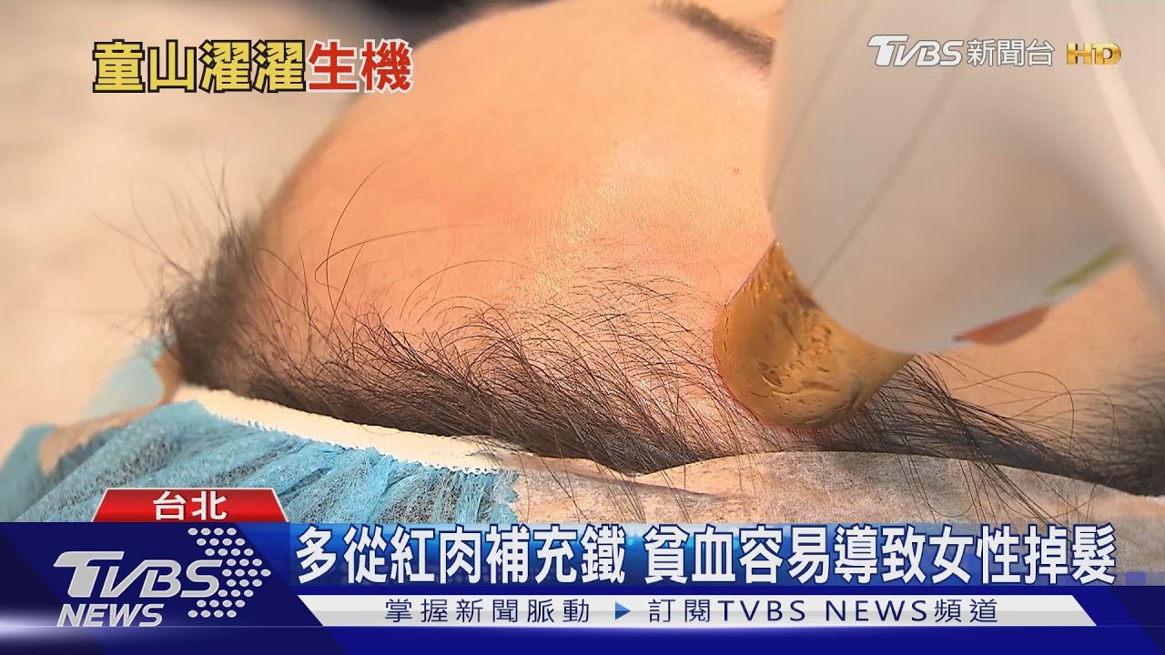 禿頭救星!台大研究「雞皮疙瘩」發現生髮密碼 登國際期刊Cell