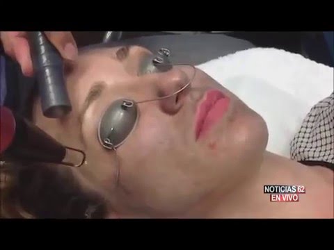 El Acné, Enemigo de la piel: Minuto Medico