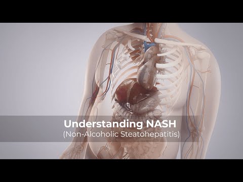 Understanding NASH (Non-Alcoholic Steatohepatitis)