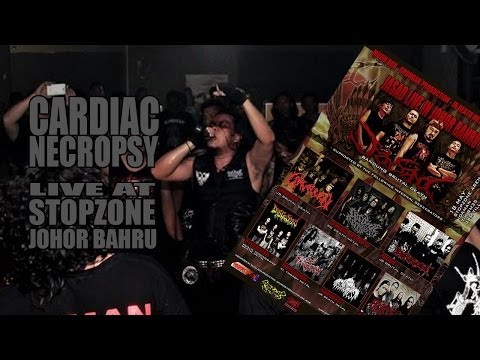 Cardiac Necropsy live at Stopzone JB 18-May 2014