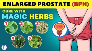 🔥 Magic Herbs to Cure Enlarged Prostate | Prostate enlargement Treatment | BPH Treatment