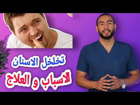 , title : 'علاج تخلخل الاسنان منزليا بدون طبيب ( حقيقه ولا خيال ) ؟!🤔 |اسباب وعلاج تخلخل الاسنان 👌💯'