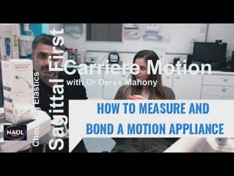 Carriere Motion - How to Measure and Bond a Motion Appliance