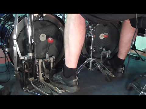 20 Anwendung Ankle Motion 180 bpm