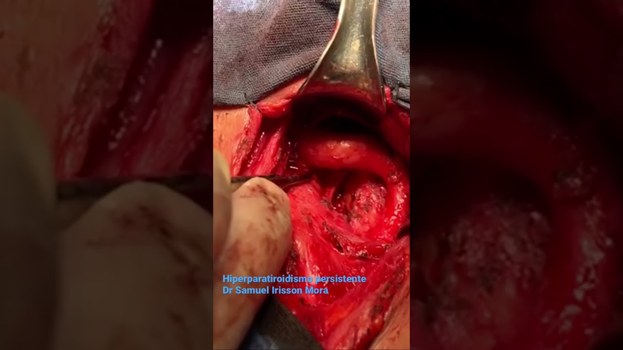 Samuel Irisson Mora-16