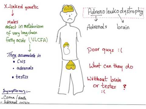 Adrenoleukodystrophy (ALD) mnemonic