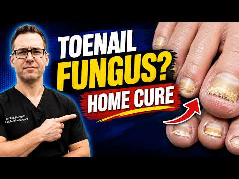Stop Toenail Fungus: A Podiatrist's Home Treatment Guide