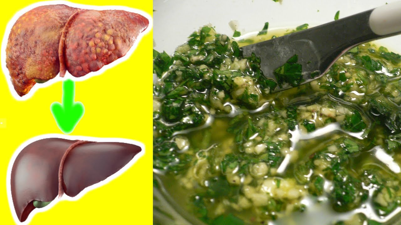 Depurare il Fegato con prezzemolo e aglio: Cosa fare per disintossicare il fegato