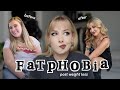Fatphobia After Losing Weight