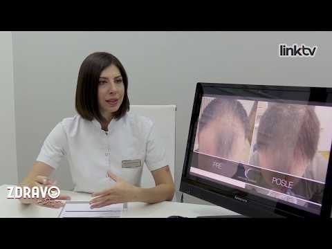 Kako pobediti ćelavost ? - Dr Elena Arsova, Zdravo sa Dunjom