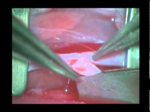 Come lecografia sulle articolazioni Che per trattare linstabilità del rachide cervicale