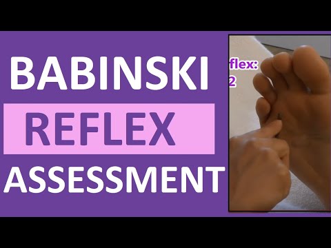 Autonomic Dysreflexia Hyperreflexia Nursing Review Symptoms Treatment