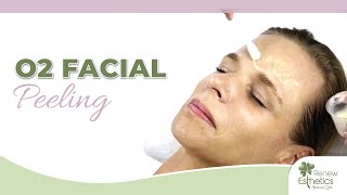 O2 Facial Peel treatment   Renew Esthetics Medical Spa   Queens NY