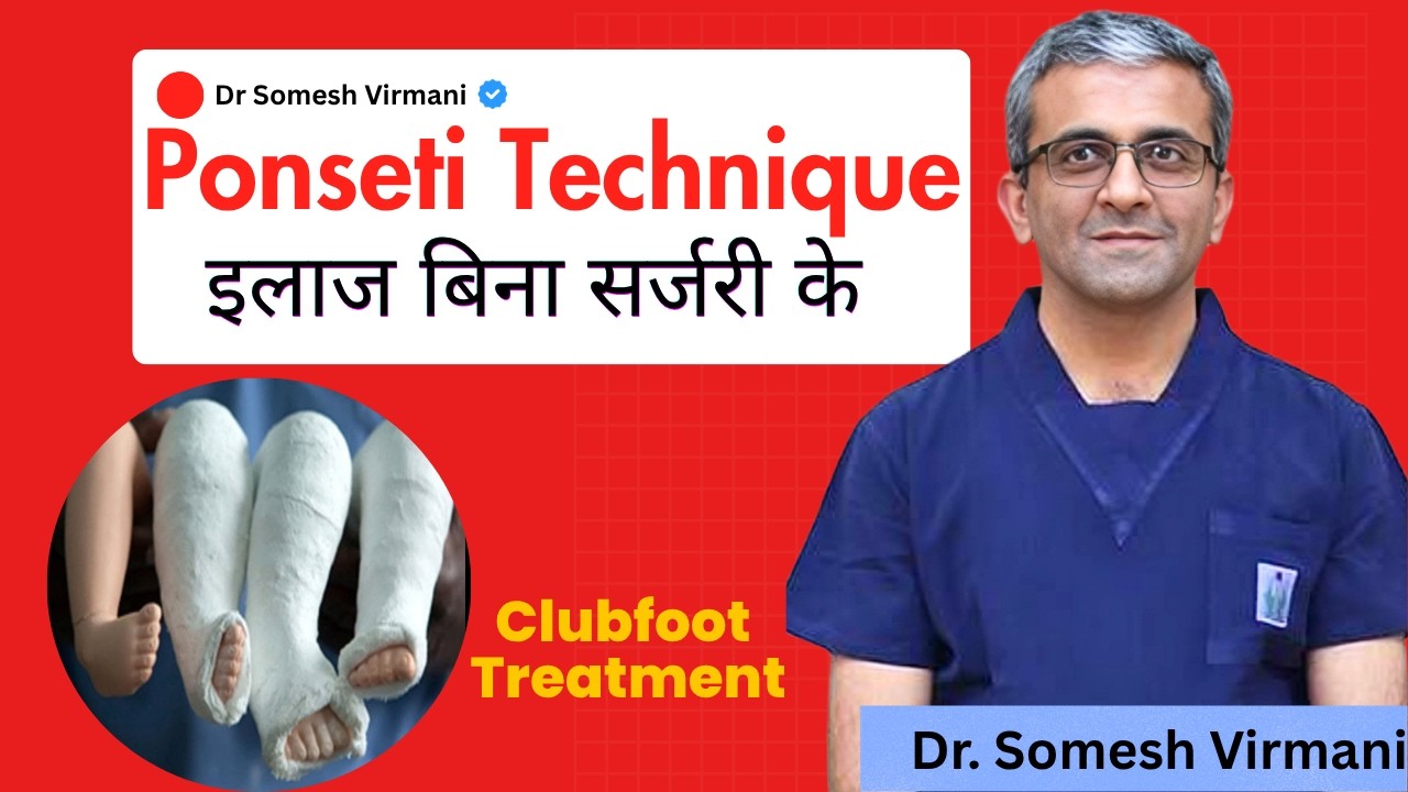 Ponseti Technique क्या है? समझिये Clubfoot Treatment Without Surgery | Dr. Somesh Virmani