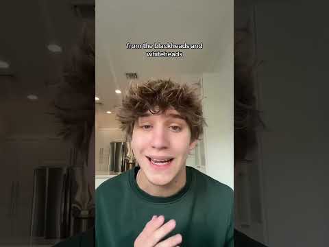 Rechargeable Blackhead Remover with 6 Suction Heads