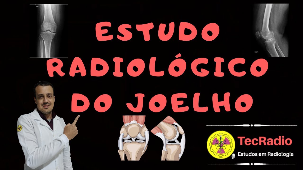 ESTUDO RADIOLÓGICO DO JOELHO
