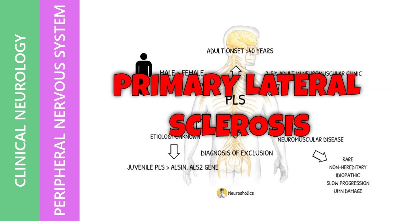 Pimary Lateral Sclerosis | Causes | Diagnosis | Treatment |  How to understand PLS? | Neuroaholics