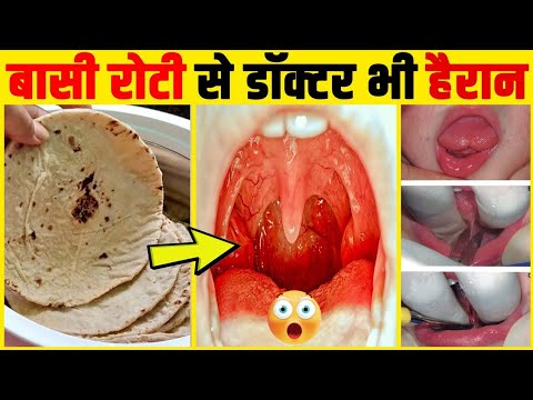 Benefits of stale bread | Benefits of eating stale bread | Benefits of eating stale bread | What ...