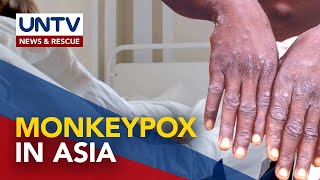 South Korea at Singapore, nakapagtala na ng kaso ng monkeypox infection