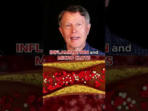 How I Use Aspirin to UNCLOG Arteries