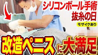 【改造ペニス】真珠5つが勃起で圧倒的存在感！抜糸風景を大公開！