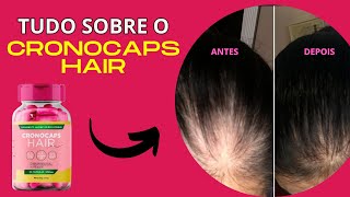 CRONOCAPS HAIR - CRONOGRAMA CAPILAR EM CÁPSULAS. CRONOCAPS HAIR FUNCIONA?  É BOM? REVELEI A  VERDADE