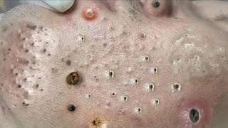 دوافع التنظيف والتجميل 𝐁𝐥𝐚𝐜𝐤𝐡𝐞𝐚𝐝 𝐑𝐞𝐦𝐨𝐯𝐞 #3369