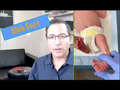 Club Foot 101: What Every Parent Needs to Know | Let's Talk About: PAK Pediatrics