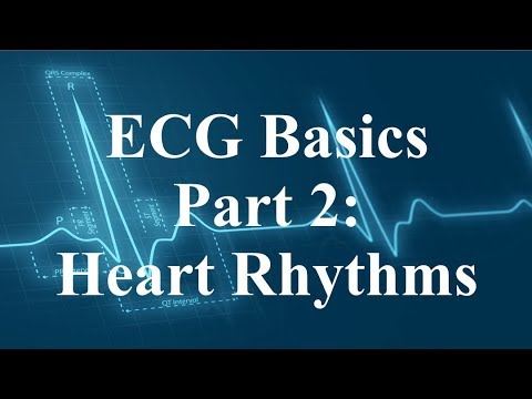 ECG Basics Part 2 - Heart Rhythms
