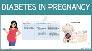 Diabetes in Pregnancy: Screening, Nursing Care, Management & Interventions