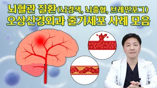 줄기세포 후기