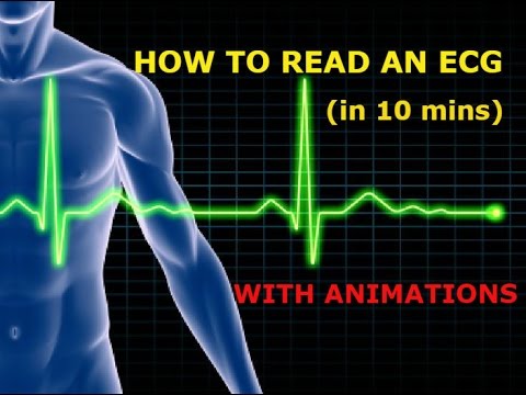 HOW TO READ AN ECG!! WITH ANIMATIONS(in 10 mins)!!