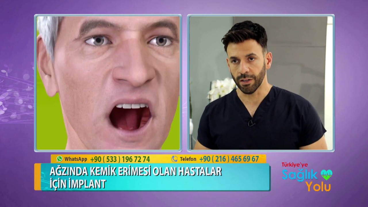 İmplant Tedavisi Kimlere Yapılır?