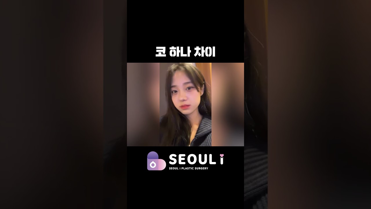 이게 진짜 코 차이..? #매부리코 #강남성형외과 #서울아이성형외과