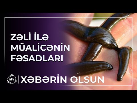 Zəlidən kortəbii müalicə hansı fəsadlara yol aça bilər?